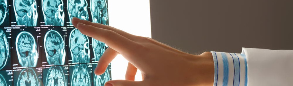 Doctor reviewing a CT scan