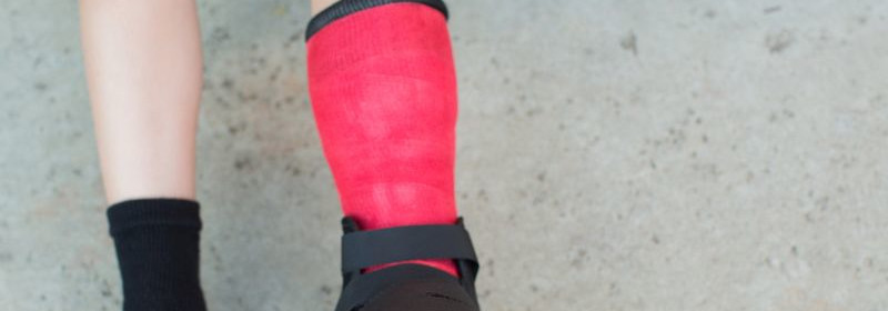 crushed foot in cast