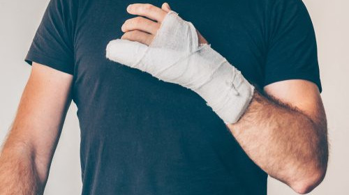 man with fractured hand raising his arm