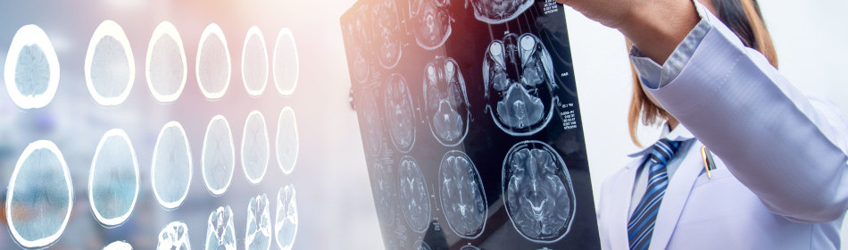 traumatic brain injury
