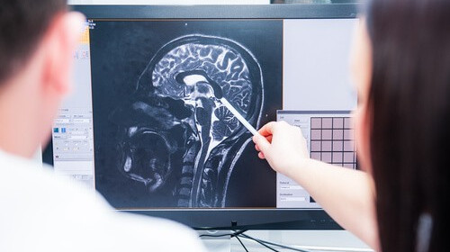 Radiologist explaining brain injury x-ray